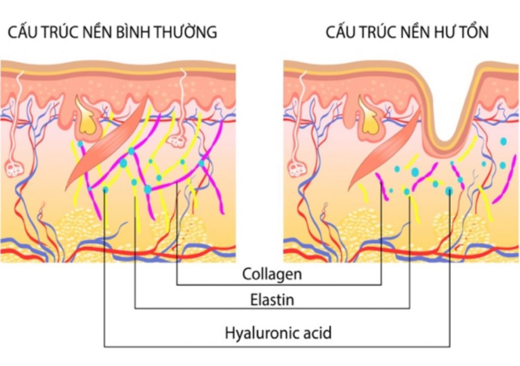 Ang hyaluronic acid nagpadako sa produksiyon ug pag-amuma sa collagen