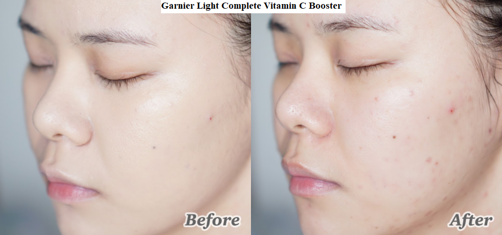hiệu quả của serum Garnier vitamin C