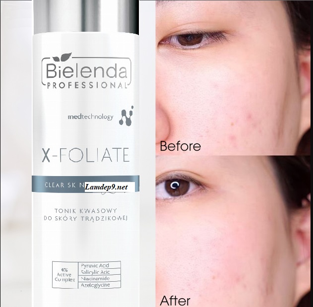 review toner Bielenda Professional X-Foliate Clear Skin